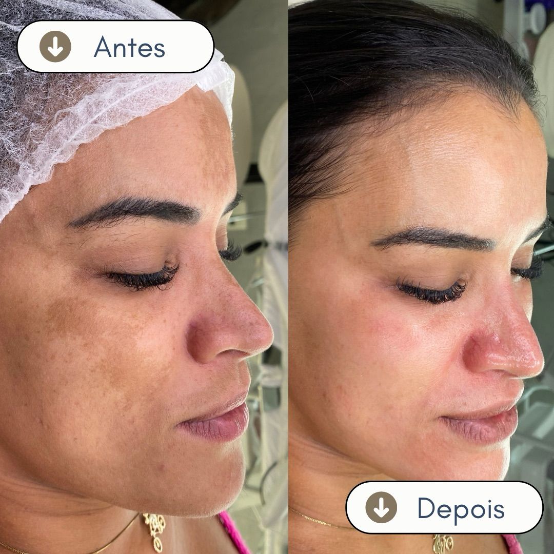 WhatsApp Image 2025-04-01 at 11.36.12