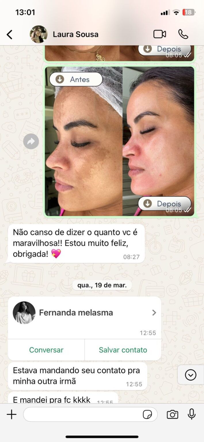 WhatsApp Image 2025-04-01 at 19.46.53